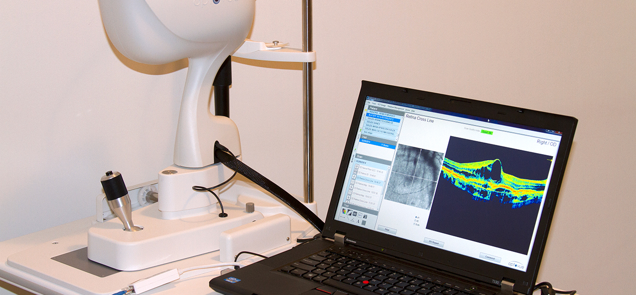 Oct tomografia de coer ncia ptica dermavisus