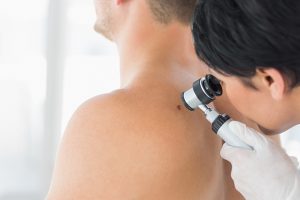 Câncer de Pele: Causas, Sintomas e Tratamentos