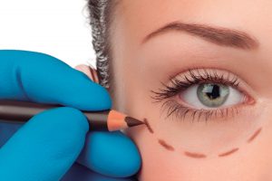 Blefaroplastia: a plástica que melhora a expressão do olhar