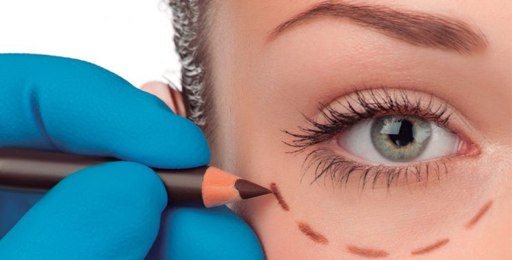 Blefaroplastia: a plástica que melhora a expressão do olhar