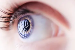 Conheça as principais dúvidas relacionadas ao glaucoma