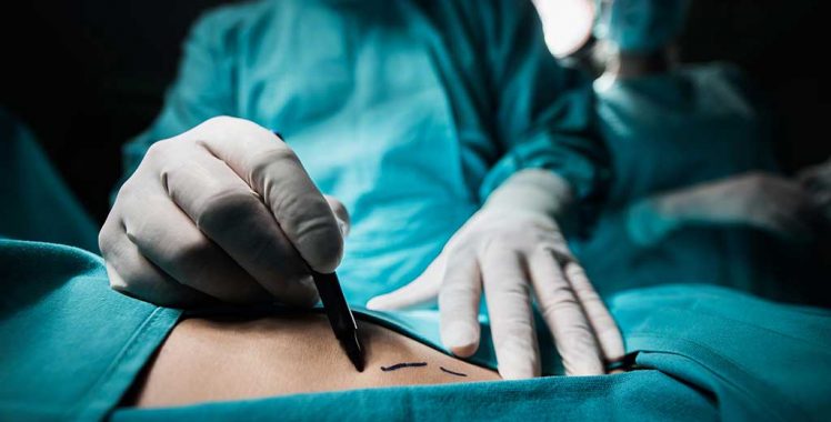 Médicos alertam para riscos em procedimentos estéticos feitos com profissionais não habilitados