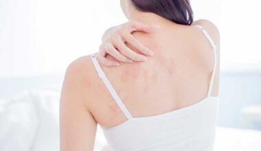 Alergias na Pele: o que são, sintomas, tipos, prevenção e tratamentos