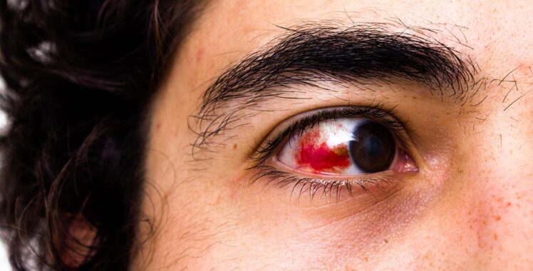 Primeiros socorros em casos de trauma ocular